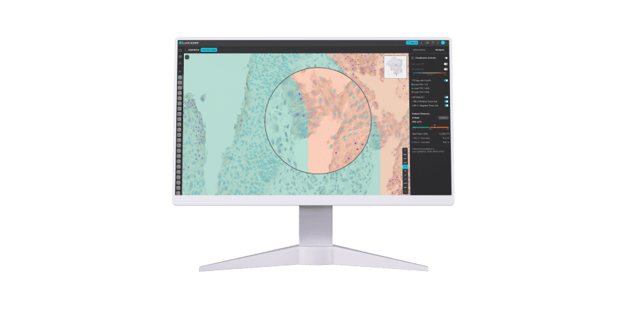 Lunit SCOPE PD-L1
