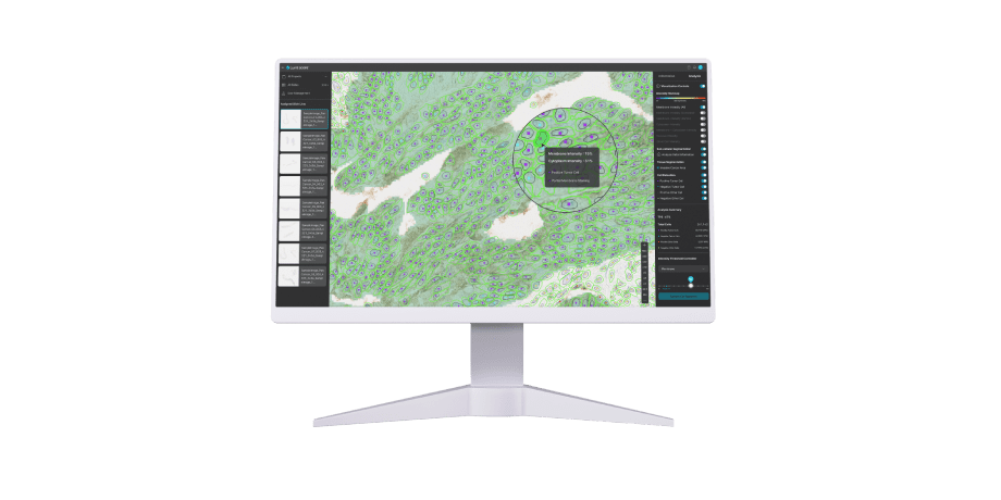 Lunit SCOPE uIHC